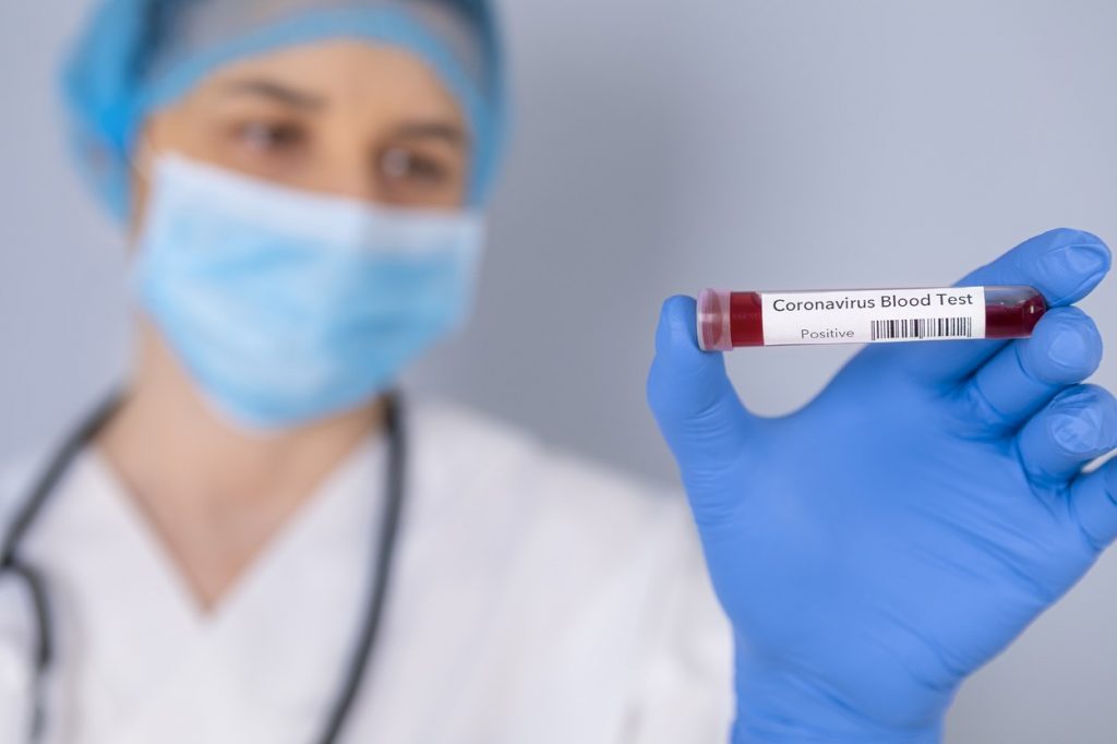 Coronavirus în România LIVE UPDATE 16 iulie: Un nou record de îmbolnăviri: 777 de cazuri în ultimele 24 de ore/ Bilanțul complet